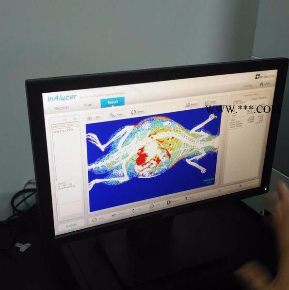 韩国MEDIKORS骨密度仪InAlyzer图3
